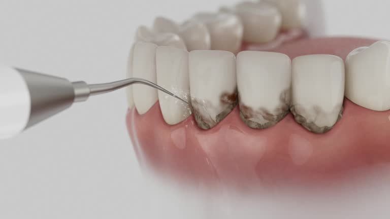 Trusted Teeth Cleaning And Checkup service in Friars Point, MS - Dentist Open Now